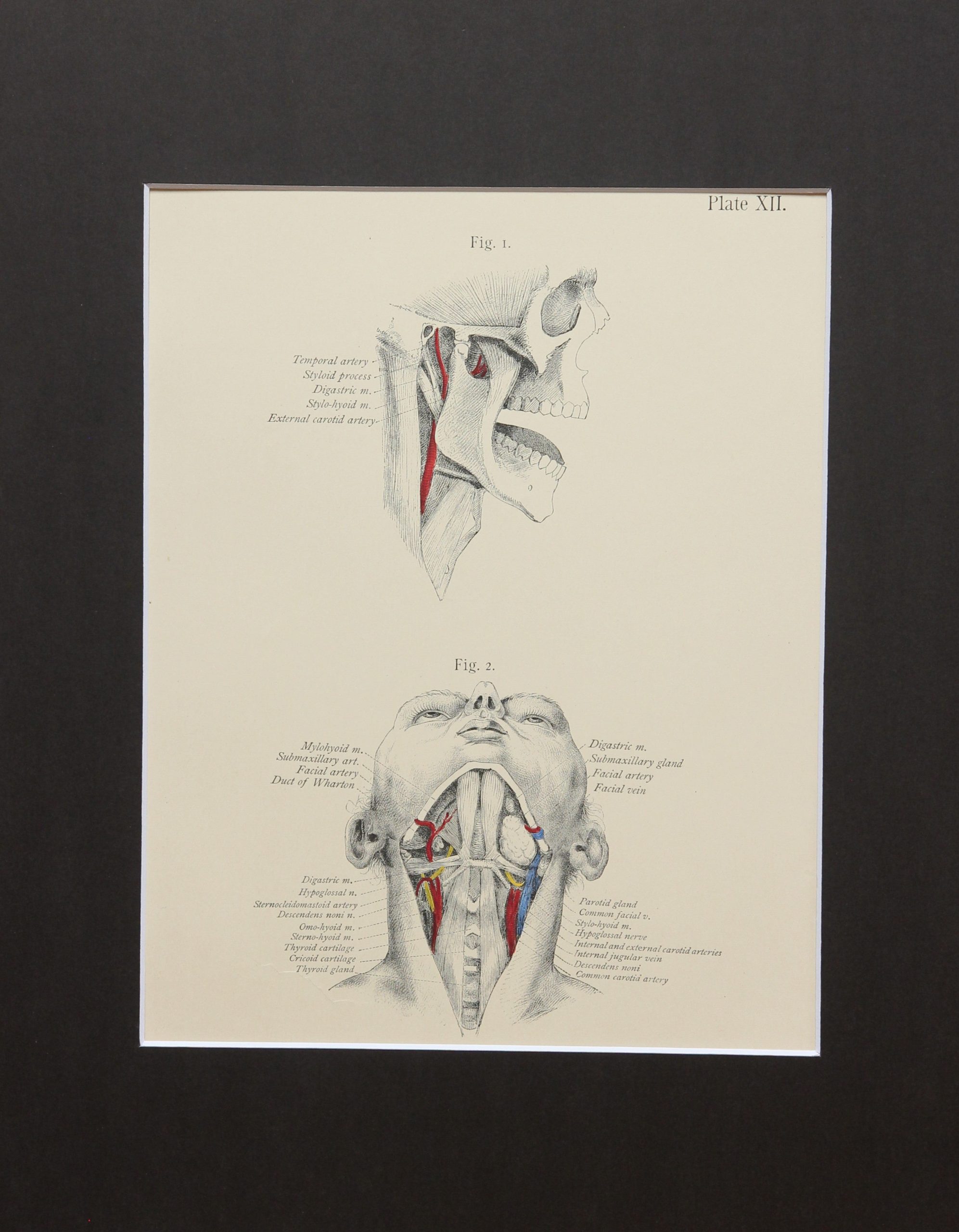 your-online-source-for-matted-antique-c-1897-anatomy-print-plate-xii-the-chin-and-neck-for-cheap_0.jpg